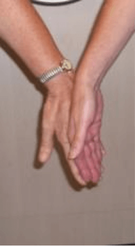 Two hands connecting back to back.